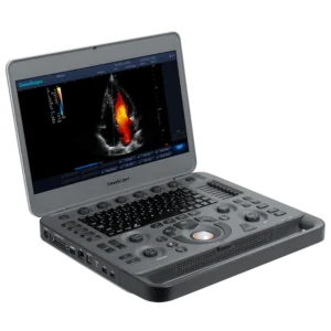 Ultrasonido digital portátil SonoScape X3 con diseño tipo laptop