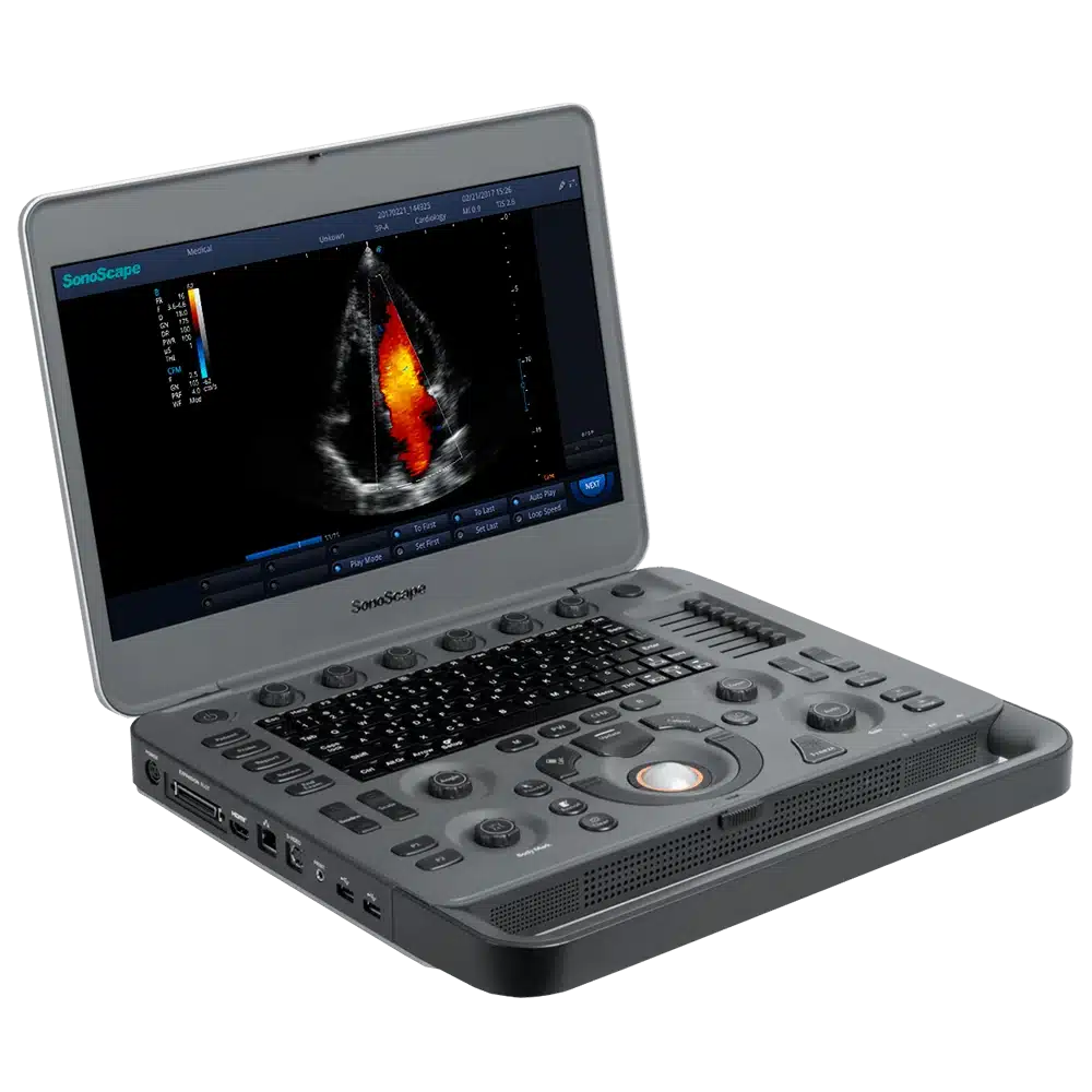 Ultrasonido digital portátil SonoScape X3 con diseño tipo laptop
