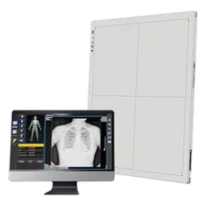 Detector DR Smartray Smart 1417 reacondicionado de 14 × 17 pulgadas para radiografía digital